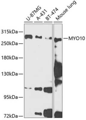 Western Blot: myosin X AntibodyBSA Free [NBP2-94033]